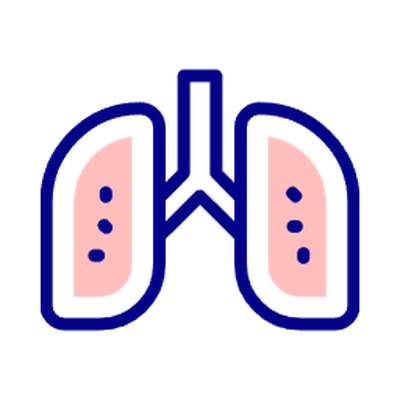 Asthma